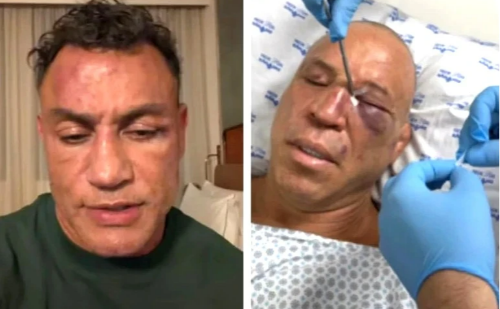 Confusão em luta com Popó deixa Wanderlei Silva com dores e perda de memória
